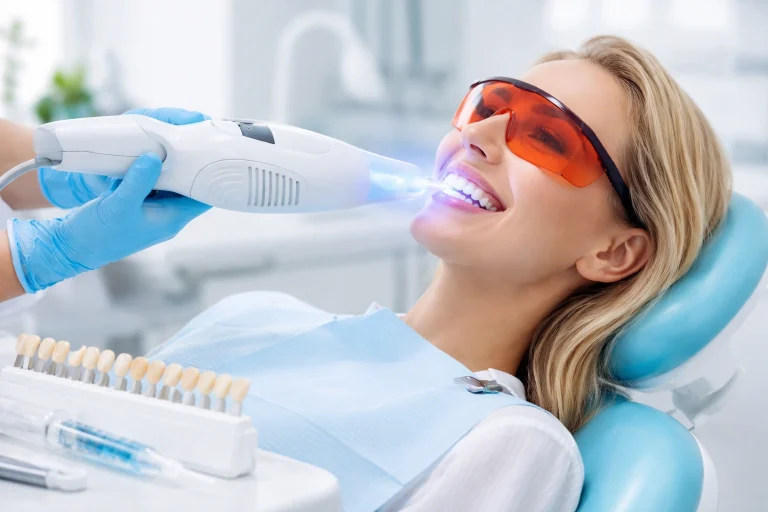 Professional Teeth Whitening: Everything You Need To Know