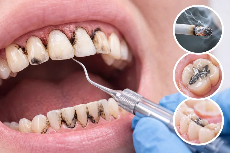 What is an Orthodontic Appliance?