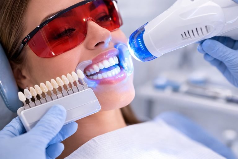 What is Teeth Whitening and What Techniques Are Used?