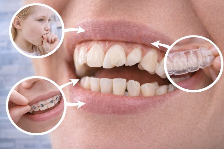 What Causes Tooth Curvature? What is the Solution?
