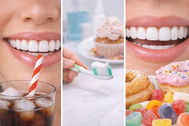Things to Consider After Teeth Whitening
