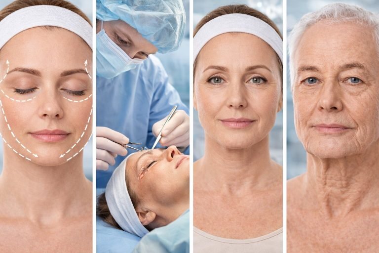 What Is a Facelift Surgery? Who Is It Suitable For?